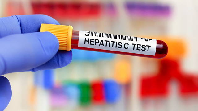 Regione Lombardia, Test Epatite