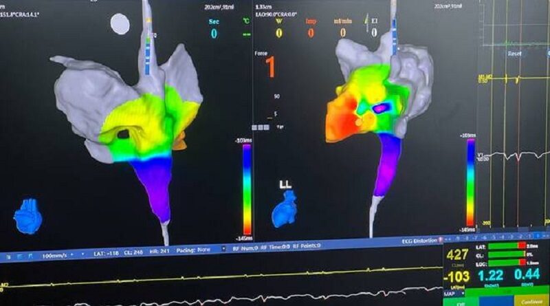 ASST Garda: da tutta Italia in cardiologia a Desenzano per il Training formativo sull’ablazione cardiaca